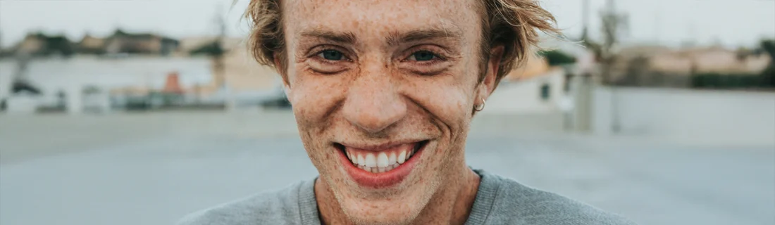 FC – Straightening Teeth with Clear Aligners at Evolve Dental